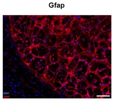 抗 GFAP 兔抗 affinity isolated antibody