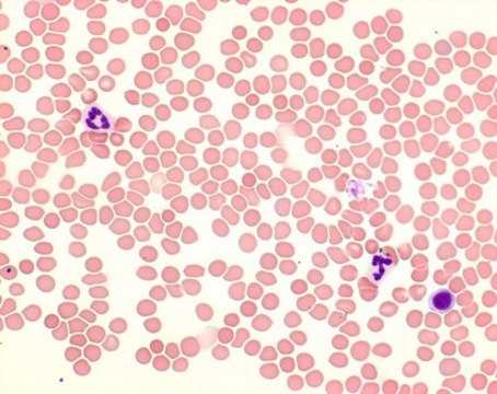 Giemsa&#8242;s天青曙红亚甲蓝溶液 for microscopy