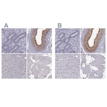 Anti-ADGRG2 antibody produced in rabbit Prestige Antibodies&#174; Powered by Atlas Antibodies, affinity isolated antibody, buffered aqueous glycerol solution