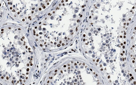 Anti-CBP Antibody, clone 3N20 ZooMAb&#174; Rabbit Monoclonal recombinant, expressed in HEK 293 cells