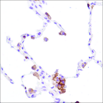 Anti-CD16A antibody, Rabbit monoclonal clone SP189, recombinant, expressed in proprietary host, affinity isolated antibody