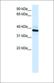 Anti-OAS1 antibody produced in rabbit affinity isolated antibody