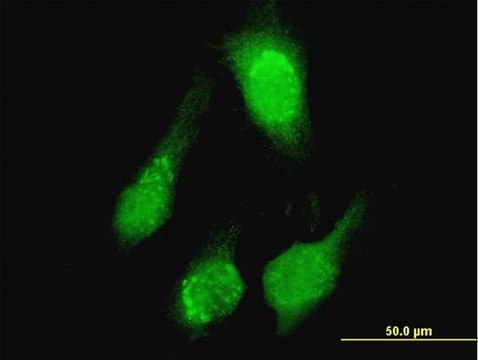 Anti-TCL1A antibody produced in mouse purified immunoglobulin, buffered aqueous solution