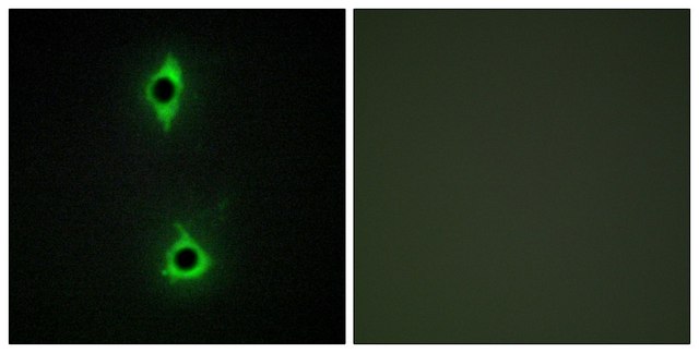 Anti-PIP5K antibody produced in rabbit affinity isolated antibody