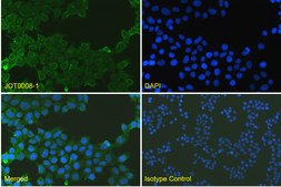 Alpaca Anti-Her2, recombinant single domain Antibody Recombinant Alpaca (VHH) Nano antibody