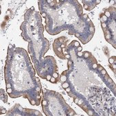 Anti-QPCTL antibody produced in rabbit Prestige Antibodies® Powered by Atlas Antibodies, affinity isolated antibody, buffered aqueous glycerol solution