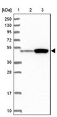 Anti-ATF7IP2 antibody produced in rabbit Prestige Antibodies® Powered by Atlas Antibodies, affinity isolated antibody, buffered aqueous glycerol solution