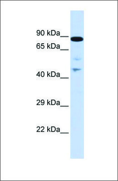 Anti-RAD54L antibody produced in rabbit affinity isolated antibody