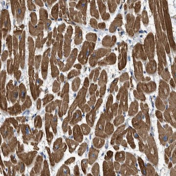 Anti-TRAK2 antibody produced in rabbit Prestige Antibodies&#174; Powered by Atlas Antibodies, affinity isolated antibody, buffered aqueous glycerol solution