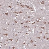 Anti-SERPINI1 antibody produced in rabbit Prestige Antibodies® Powered by Atlas Antibodies, affinity isolated antibody, buffered aqueous glycerol solution