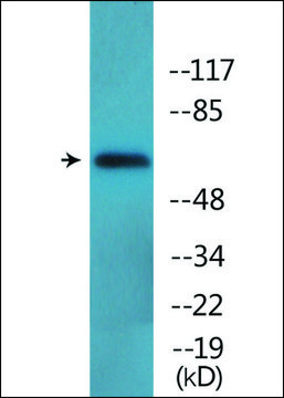 Anti-phospho-Moesin/Ezrin/Radixin (pThr558) antibody produced in rabbit affinity isolated antibody