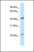 Anti-BCKDHA, (N-terminal) antibody produced in rabbit affinity isolated antibody