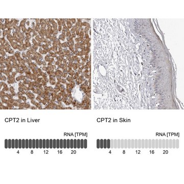 Anti-CPT2 antibody produced in rabbit Prestige Antibodies&#174; Powered by Atlas Antibodies, affinity isolated antibody, buffered aqueous glycerol solution, ab2