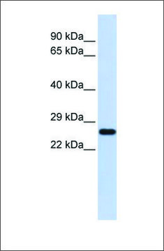 Anti-SOD2 antibody produced in rabbit affinity isolated antibody