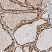 Anti-KYAT3 antibody produced in rabbit Prestige Antibodies® Powered by Atlas Antibodies, affinity isolated antibody, buffered aqueous glycerol solution, Ab1