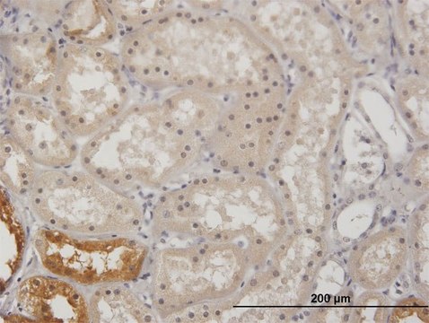 Anti-GK antibody produced in mouse IgG fraction of antiserum, buffered aqueous solution