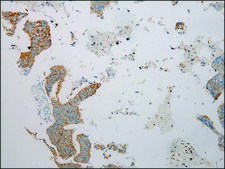 抗-TRIM62 affinity isolated antibody