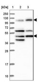 Anti-IFT122 antibody produced in rabbit Prestige Antibodies® Powered by Atlas Antibodies, affinity isolated antibody, buffered aqueous glycerol solution