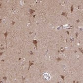 Anti-TIMM50 antibody produced in rabbit Prestige Antibodies® Powered by Atlas Antibodies, affinity isolated antibody, buffered aqueous glycerol solution