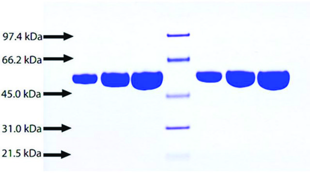 Alpha 1 Antitrypsin from human plasma HBsAg, HCV, HBc free, &#8805;95% (SDS-PAGE)