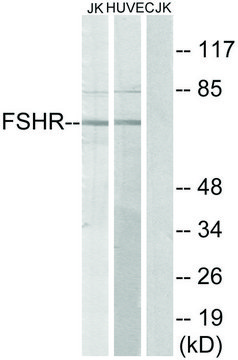 Anti-FSHR antibody produced in rabbit affinity isolated antibody