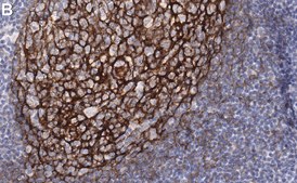 Anti-p75NTR Antibody, clone 1N3 ZooMAb® Rabbit Monoclonal recombinant, expressed in HEK 293 cells