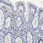 Anti-CRB3 antibody produced in rabbit Prestige Antibodies® Powered by Atlas Antibodies, affinity isolated antibody, buffered aqueous glycerol solution