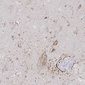 Anti-HTR2A antibody produced in rabbit Prestige Antibodies® Powered by Atlas Antibodies, affinity isolated antibody, buffered aqueous glycerol solution