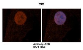 Anti-VIM affinity isolated antibody