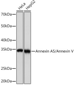 Anti-Annexin A5/Annexin V Antibody, clone 9A5M8, Rabbit Monoclonal