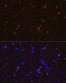 Anti-NMDAR1 antibody produced in rabbit