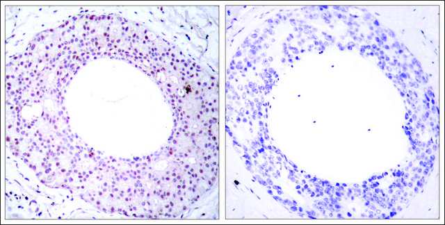 Anti-phospho-RELA (p65/pThr254) antibody produced in rabbit affinity isolated antibody