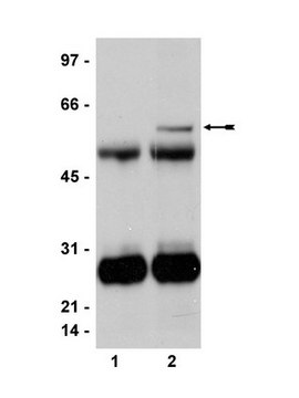 Anti-HFH-4/FOXJ1 Antibody, clone 3-19 ascites fluid, clone 3-19, Upstate&#174;