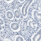 Anti-KRT76 antibody produced in rabbit Prestige Antibodies® Powered by Atlas Antibodies, affinity isolated antibody, buffered aqueous glycerol solution, Ab1