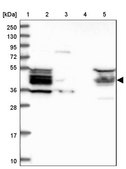 Anti-HOMER2 antibody produced in rabbit Prestige Antibodies® Powered by Atlas Antibodies, affinity isolated antibody, buffered aqueous glycerol solution