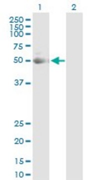 Anti-KRT7 antibody produced in rabbit purified immunoglobulin, buffered aqueous solution