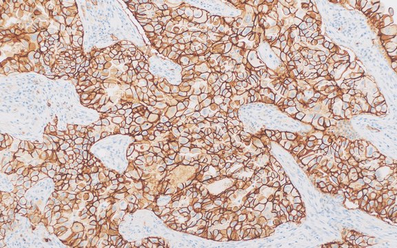 Claudin-4 (EP417) Rabbit Monoclonal Primary Antibody