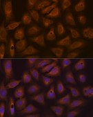 Anti-CAD Antibody, clone 0O8D6, Rabbit Monoclonal