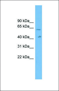 Anti-SLC22A10 antibody produced in rabbit affinity isolated antibody