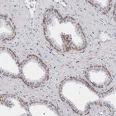 Anti-NUDT18 antibody produced in rabbit Prestige Antibodies® Powered by Atlas Antibodies, affinity isolated antibody, buffered aqueous glycerol solution