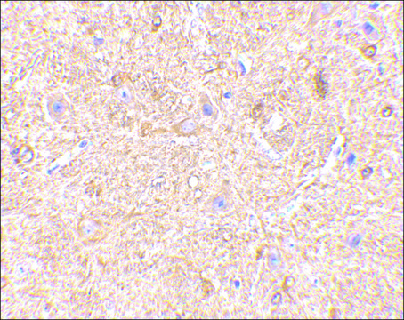 Anti-VISA (ab2) antibody produced in rabbit affinity isolated antibody, buffered aqueous solution