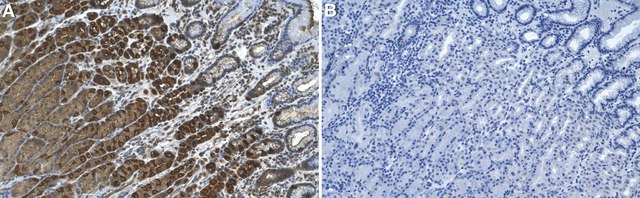 Anti-Rab11 Antibody, clone 1C16 ZooMAb&#174; Rabbit Monoclonal recombinant, expressed in HEK 293 cells