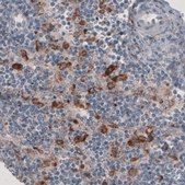 Monoclonal Anti-FCGRT antibody produced in mouse Prestige Antibodies® Powered by Atlas Antibodies, clone CL3638, purified immunoglobulin, buffered aqueous glycerol solution