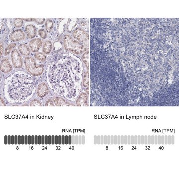 Anti-SLC37A4 antibody produced in rabbit Prestige Antibodies&#174; Powered by Atlas Antibodies, affinity isolated antibody, buffered aqueous glycerol solution