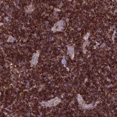 Anti-ARHGEF18 antibody produced in rabbit Prestige Antibodies® Powered by Atlas Antibodies, affinity isolated antibody, buffered aqueous glycerol solution