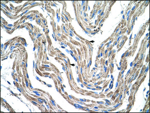 Anti-PDK4 antibody produced in rabbit affinity isolated antibody