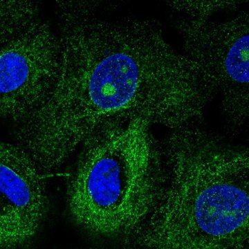 Anti-MTUS1 antibody produced in rabbit Prestige Antibodies&#174; Powered by Atlas Antibodies, affinity isolated antibody