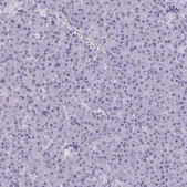 Anti-AKAP5 antibody produced in rabbit Prestige Antibodies® Powered by Atlas Antibodies, affinity isolated antibody, buffered aqueous glycerol solution