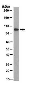 Anti-Plakophilin-2 Antibody, clone 8H6 clone 8H6, from mouse