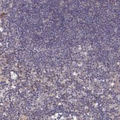 Anti-IRGQ antibody produced in rabbit Prestige Antibodies® Powered by Atlas Antibodies, affinity isolated antibody, buffered aqueous glycerol solution